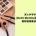 ズッチマティア　整形